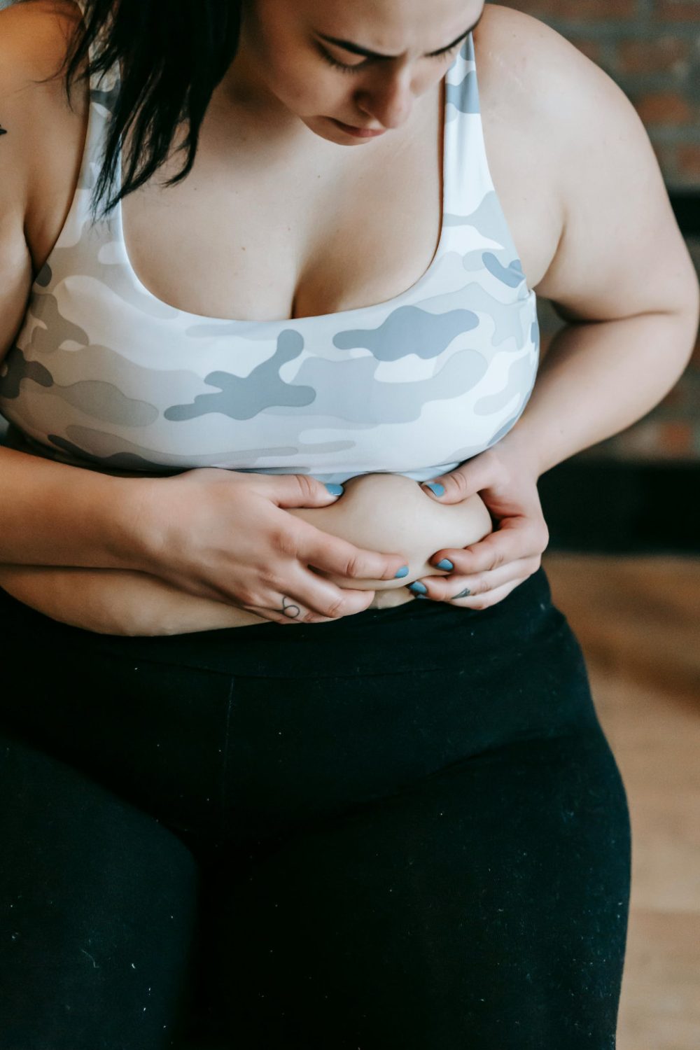 Tummy Tuck Vertical